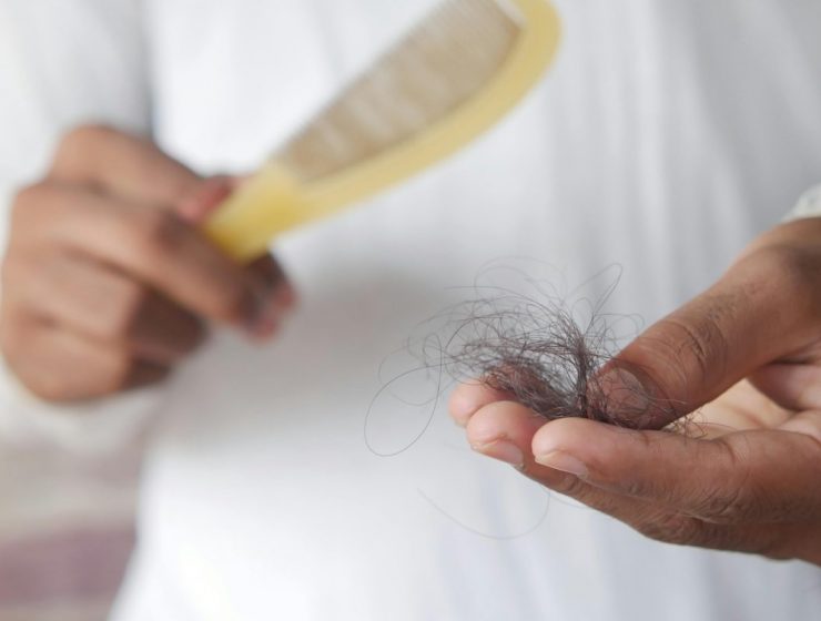 Tackle hair shedding